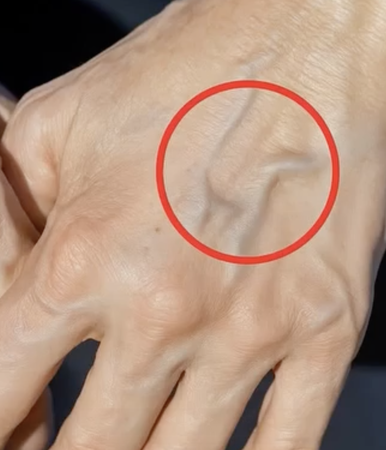 Why Your Veins Suddenly Look More Visible
