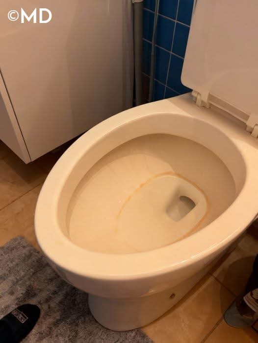 Easy Ways to Remove Hard Water Stains