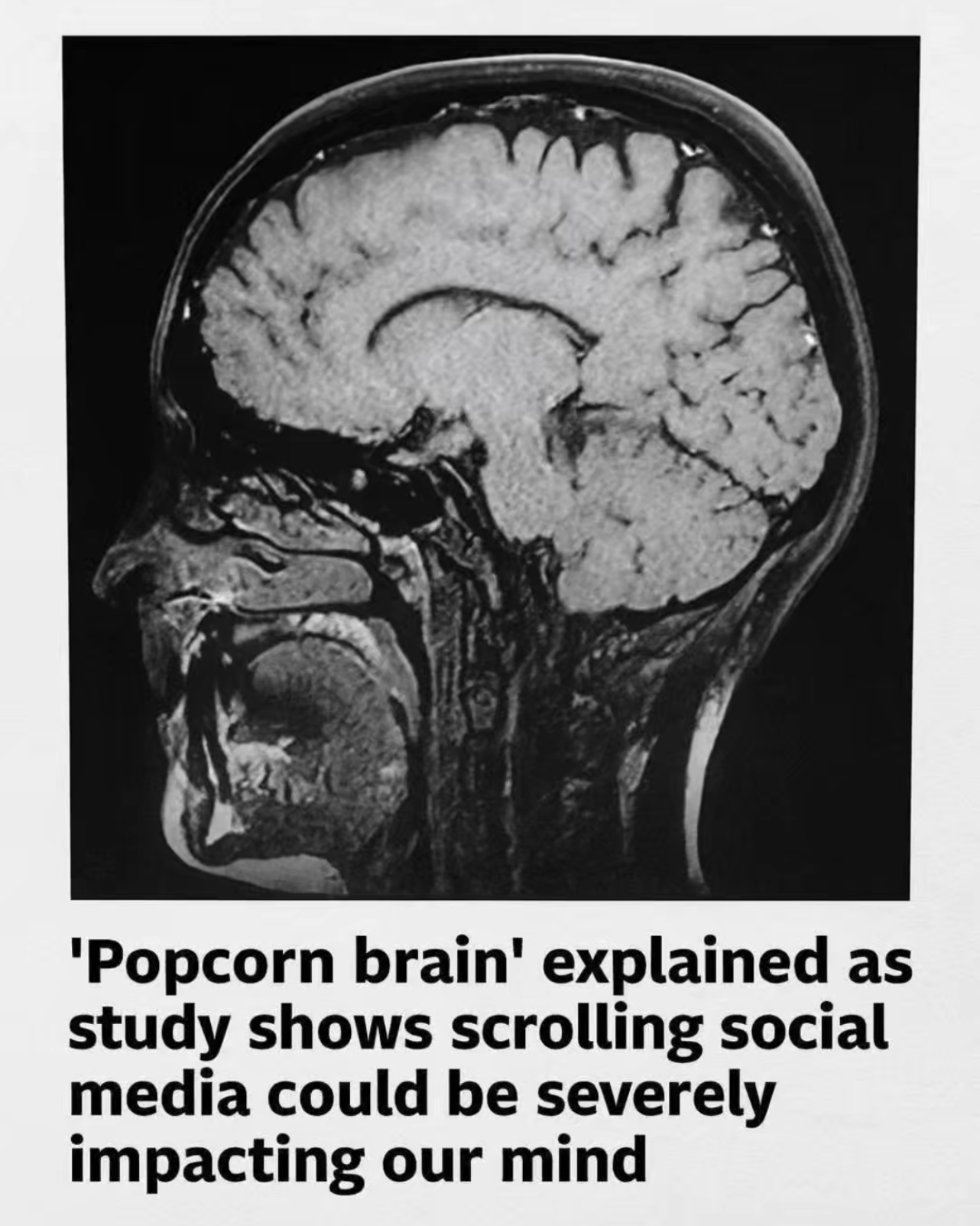 New Study Warns That ‘Popcorn Brain’ Is Becoming a Growing Mental Health Concern Among Heavy Social Media Users