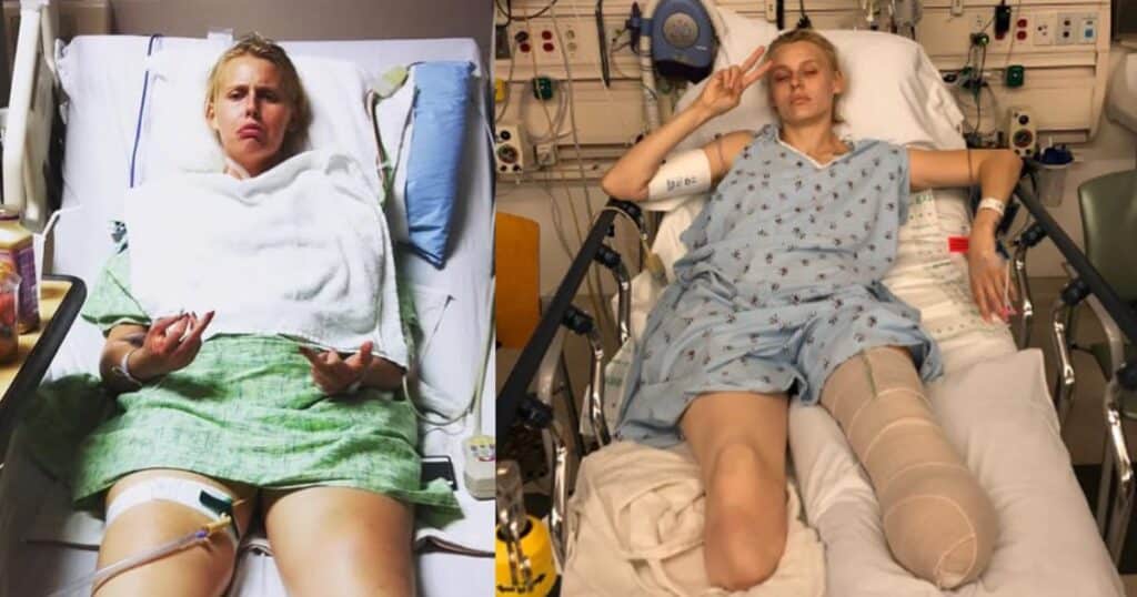 Her legs are amputated after using a common household product