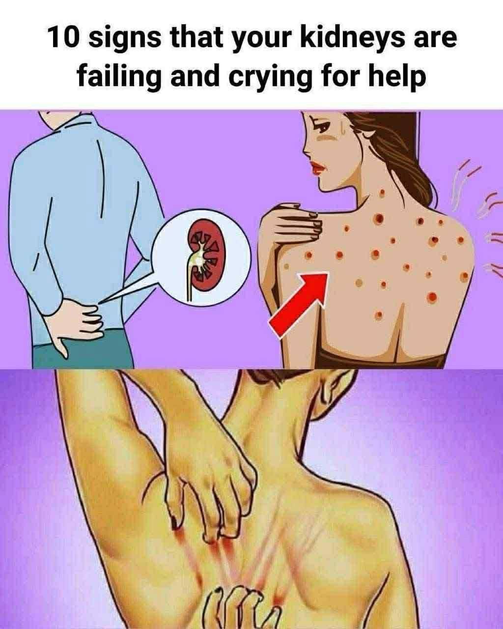 10 Early Signs Your Kidneys May Need Attention