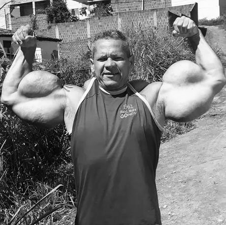 With Heavy Hearts: A Global Sensation’s Extreme Obsession Ends in Tragedy at 55