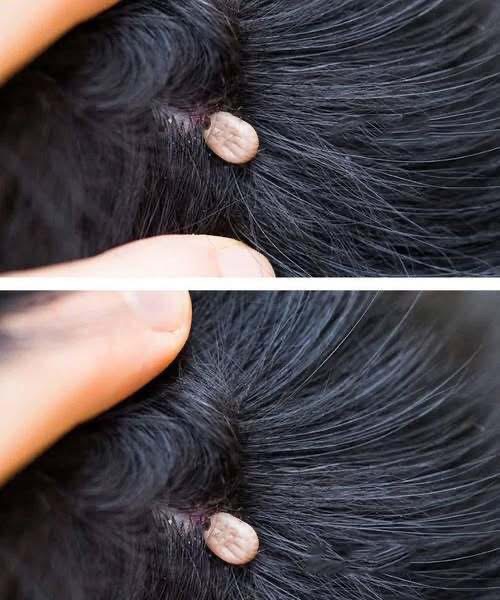 A Mysterious Lump in a Child’s Hair Sparks Concern and Questions