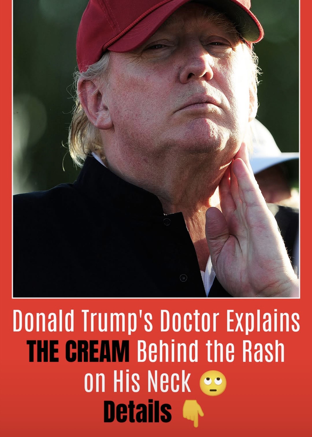 What’s Behind the Rash on Donald Trump’s Neck – His Doctor Breaks Silence