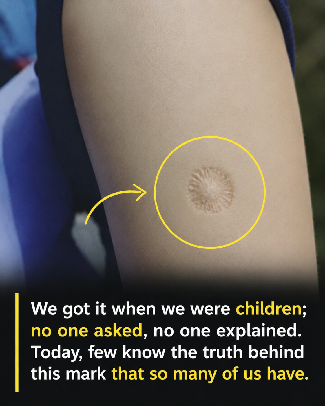 What the small round scar on your arm might indicate